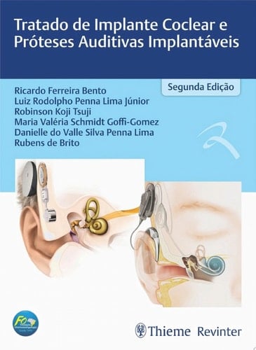 Tratado de Implante Coclear e Próteses Auditivas Implantáveis