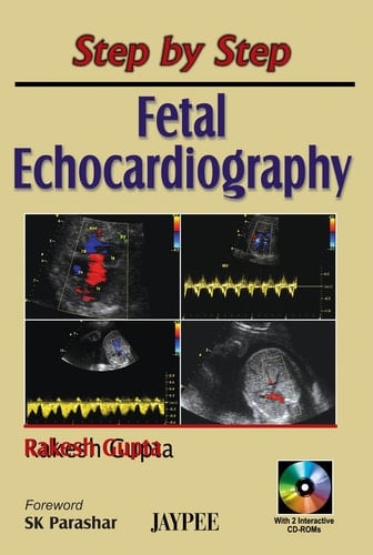 Fetal Echocardiography with 2 Inst