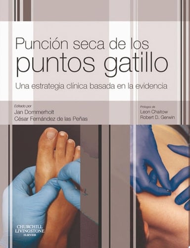 Punción seca de los puntos gatillo Una estrategia clínica basada en la evidencia