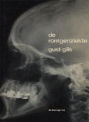 De röntgenziekte