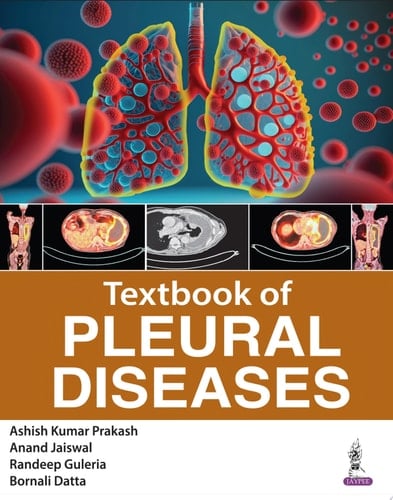 Textbook of Pleural Diseases