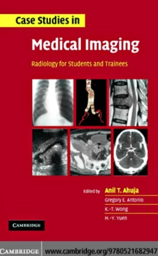 Case studies in medical imaging