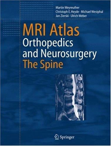 MRI atlas