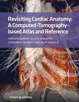Revisiting Cardiac Anatomy A Computedtomographybased Atlas And Reference